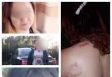 EXCLUSIVITATE: O femeie din Poienile de Sub Munte bătută crunt de cumnat (galerie foto)