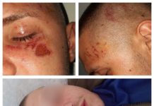 EXCLUSIVITATE – BORȘA SĂLBATICĂ: Adolescent de 17 ani bătut cu sălbăticie de Colț Alb. ESTE RECIDIVIST!!! Procurorii aud oare? (galerie foto șocantă)