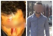 EXCLUSIVITATE: Bătut crunt în Complex Borșa pentru că s-ar fi uitat urât la el (foto cititori)