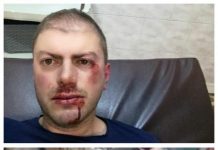 SENTINȚĂ: Borșeanul Colț Alb condamnat la închisoare și muncă în folosul comunității după ce a agresat un salvamontist din Borșa