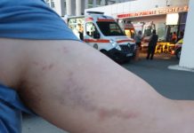 EXCLUSIVITATE / ACTUALIZARE: Sechestrat și bătut pentru că și-a cerut banii pentru munca prestată la Hotel Castel Transilvania. Ce spun reprezentanţii firmei de pază şi proprietarul complexului (galerie foto)