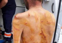 EXCLUSIV – GALERIE FOTO / ACTUALIZARE: Un păstor din Rogoz bătut cu bestialitate de un localnic din Suciu de Jos. Ce spun poliţiştii