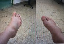 DE LA CITITORI: „M-a făcut zdreanță împuțită doamna doctor de la Spitalul Județean de Urgență Baia Mare!!!” (GALERIE FOTO)