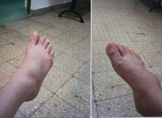 DE LA CITITORI: „M-a făcut zdreanță împuțită doamna doctor de la Spitalul Județean de Urgență Baia Mare!!!” (GALERIE FOTO)