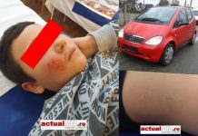 APEL PE FACEBOOK: Copil lovit de mașină pe trecere, în Baia Mare. Șoferul a fugit (FOTO / ACTUALIZARE)