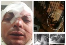 EXCLUSIV CITITORI – IMAGINI ÎNGROZITOARE / ACTUALIZARE: Un tânăr a fost bătut și aruncat în cap de pe scările unui club din Baia Mare (VIDEO – interviu cu victima)