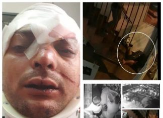 EXCLUSIV CITITORI – IMAGINI ÎNGROZITOARE / ACTUALIZARE: Un tânăr a fost bătut și aruncat în cap de pe scările unui club din Baia Mare (VIDEO – interviu cu victima)