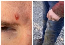 ȘTIRE CITITORI – FOTO EXCLUSIV: În Borșa, o artistă de muzică populară și soțul ei atacați cu pietre, agresați fizic și verbal