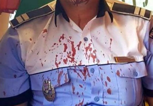INCIDENT GRAV: Patrulă de poliție snopită în bătaie la Berbești în miez de noapte. Unul are nevoie de 14 zile de îngrijiri medicale