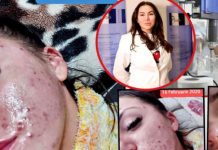 FOTO ȘOCANT: O sigheteancă a ajuns victima ”dermatologului vedetelor”. A ajuns la spital în șoc anafilactic