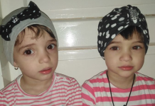 PRELUARE DIRECTMM.RO: Două fetițe gemene în vârstă de doi ani din Sighet riscă să își piardă vederea. Familia nu are posibilități materiale pentru tratament (FOTO)