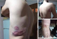 ȘOCANT: FOTO /VIDEO EXCLUSIV – Un bărbat din Vișeu de Sus susține că a fost bătut măr de 3 polițiști tocmai în sediul POLIȚIEI (ACTUALIZARE 2)