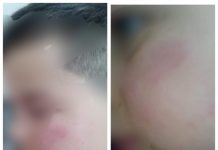 EXCLUSIV FOTO: ȘOCANT – Un băiețel de 7 ani din Repedea a fost lovit de tatăl unei colege chiar în sala de clasă în timpul orei, sub privirile îngrozite ale învățătoarei (actualizare)