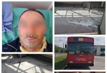 EXCLUSIV FOTO: ATENTAT ÎN BAIA MARE – Unui șofer de la Urbis i-a explodat în față recipientul cu dezinfectant duce ce acesta ar fi fost aprins de ”călători clandestini” în zona Combinatului (actualizare)