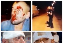 VIDEO EXCLUSIV: Un băimărean susține că ar fi fost desfigurat de polițiști sub privirile propriului copil de 6 ani. Petrecea de ziua soției lui. Poliția susține că a cazut pentru că era beat (actualizare)